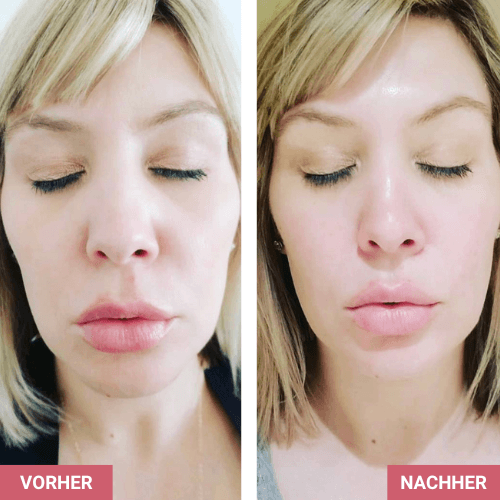 Vorher / Nachher