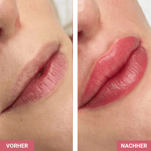 Vorher / Nachher