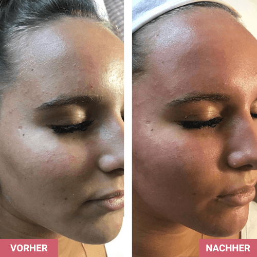 Vorher / Nachher