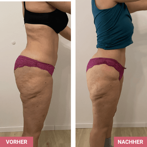 Vorher / Nachher