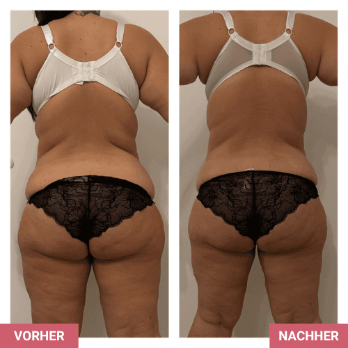 Vorher / Nachher