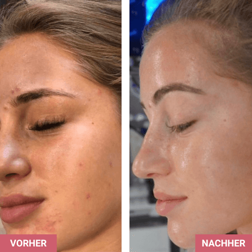 Vorher / Nachher