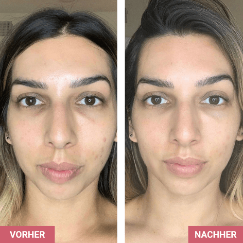 Vorher / Nachher