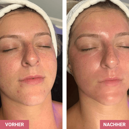 Vorher / Nachher