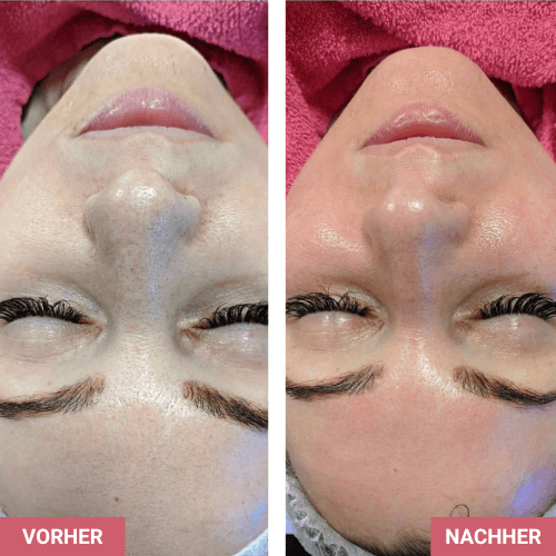 Vorher / Nachher