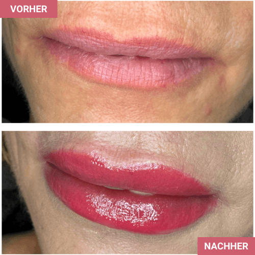 Vorher / Nachher