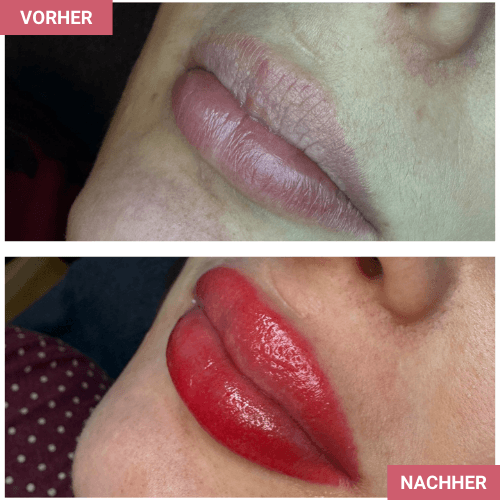 Vorher / Nachher