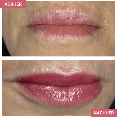 Vorher / Nachher