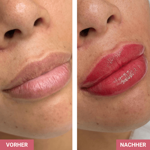 Vorher / Nachher