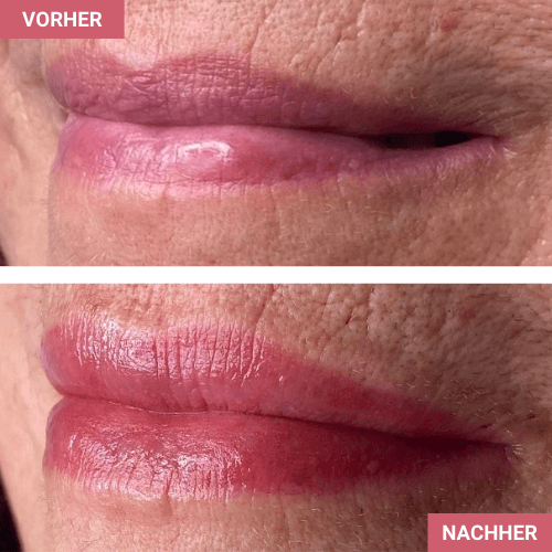 Vorher / Nachher