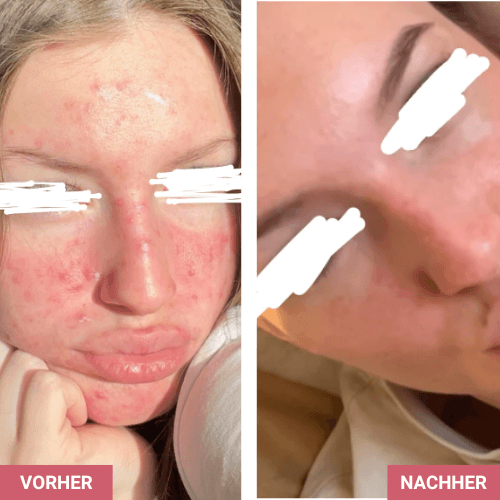 Vorher / Nachher