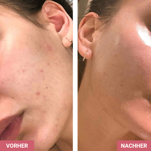 Vorher / Nachher