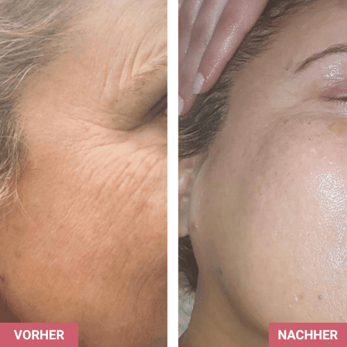 Vorher / Nachher