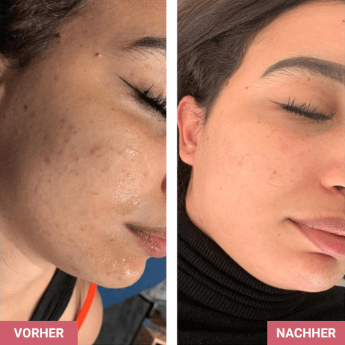 Vorher / Nachher