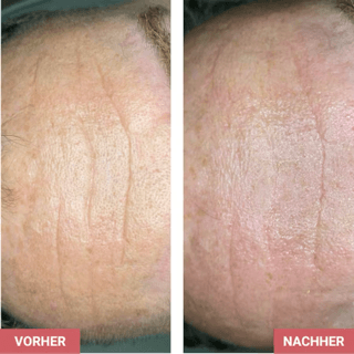 Vorher / Nachher