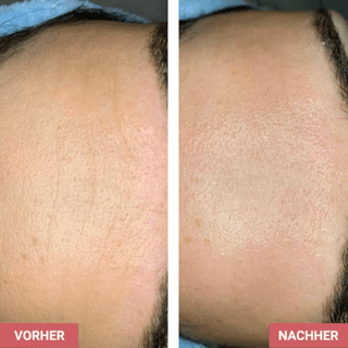Vorher / Nachher