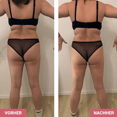 Vorher / Nachher