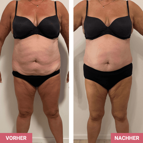Vorher / Nachher