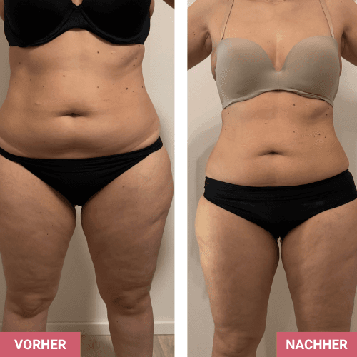 Vorher / Nachher