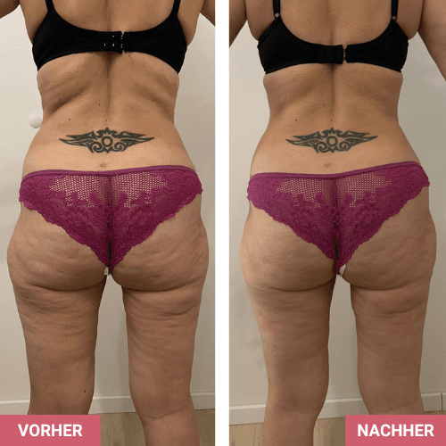 Vorher / Nachher